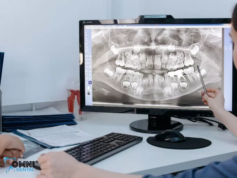 The Role of the Dentist in Invisalign Treatment with Crowns