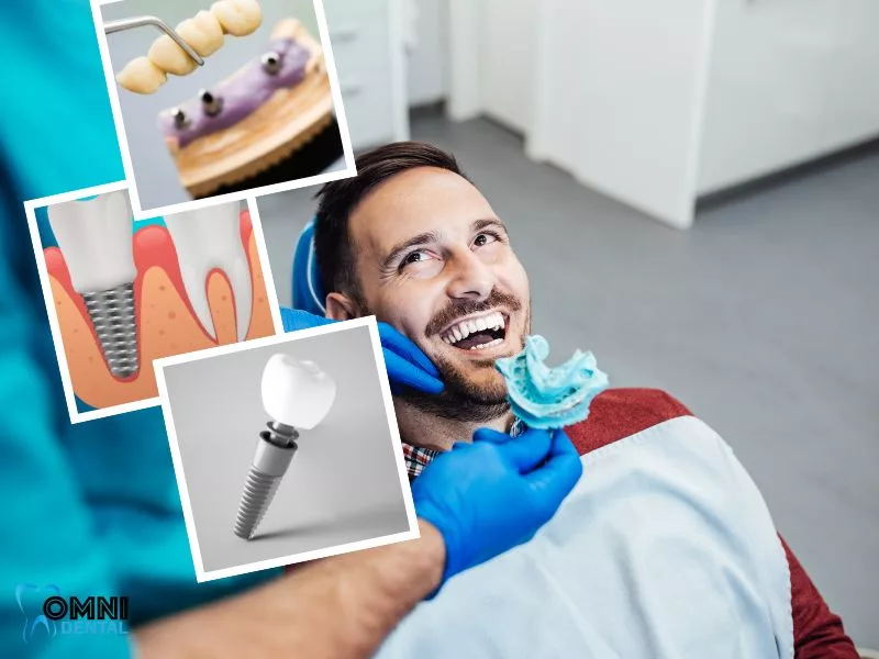 dental implant Aftercare and Maintenance