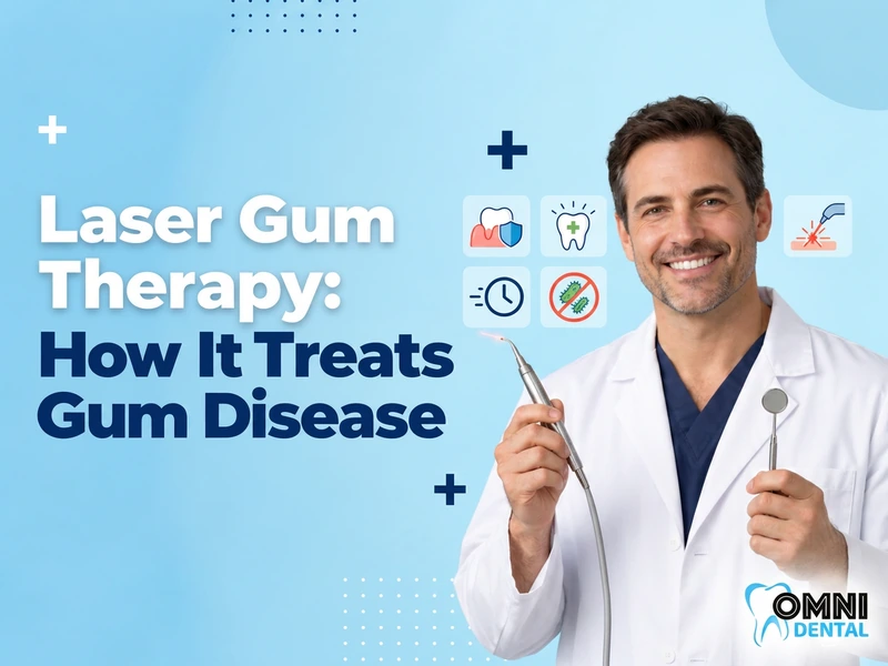 All About Laser Gum Therapy
