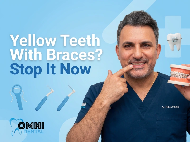 Best Tips for Oral Care During Braces Treatment