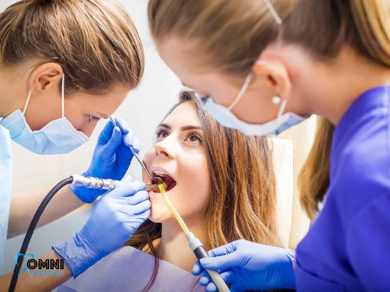 dental fillings service