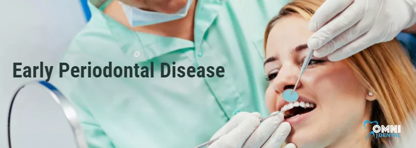 Early Periodontal Disease