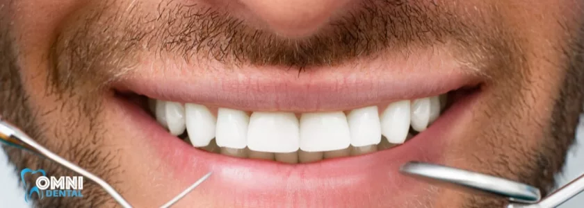 Effective Gum Disease Treatment for Beautiful Smile