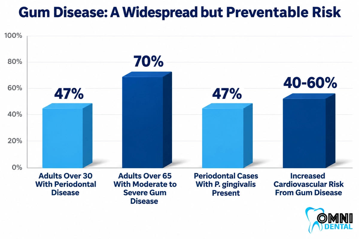 Facts About Gum Disease and Cardiovascular Risk