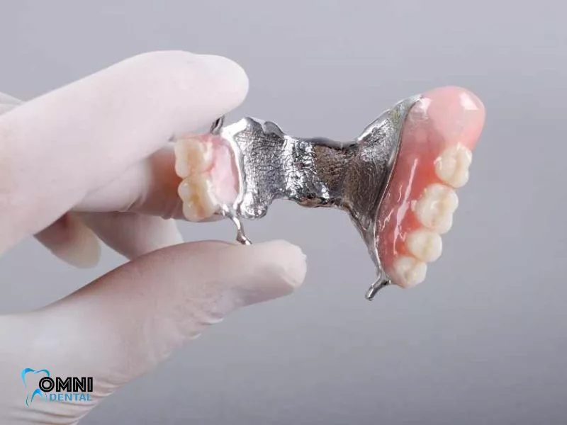 Pros and Cons of Flipper Teeth