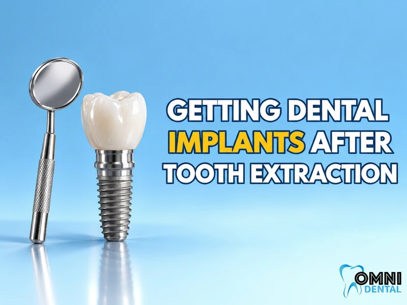 Getting Dental Implants After Tooth Extraction