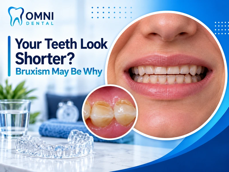 How Bruxism Impacts Your Teeth