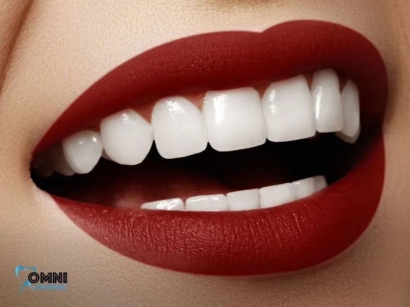 More Information on Teeth Whitening