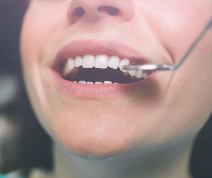 Common signs of a cracked tooth