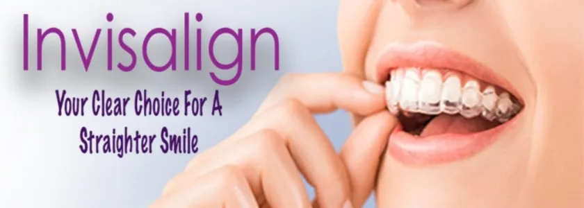 Wearing Invisalign With Dental Crowns
