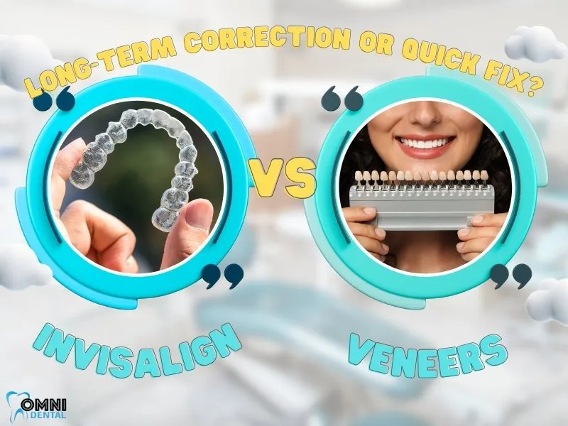 Invisalign vs Veneers Which One is Right for You