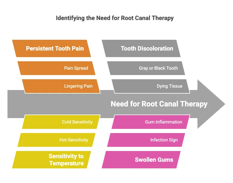 Key Signs You May Need a Root Canal