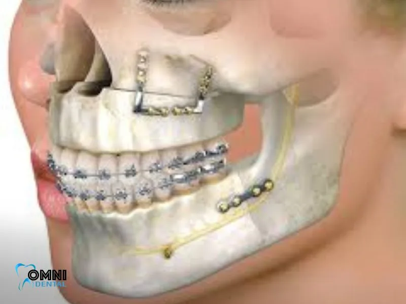 Dental Emergencies