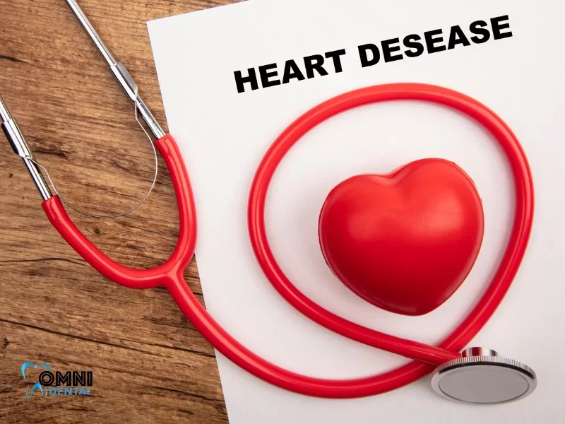Link Between Oral Health and Heart Disease