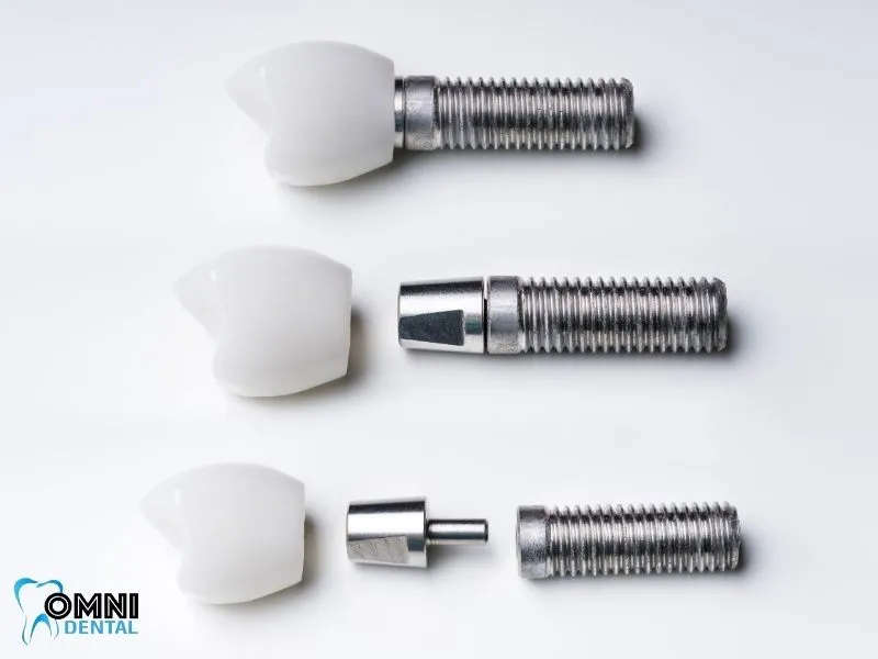 Preventing Peri-implantitis with Proper Care