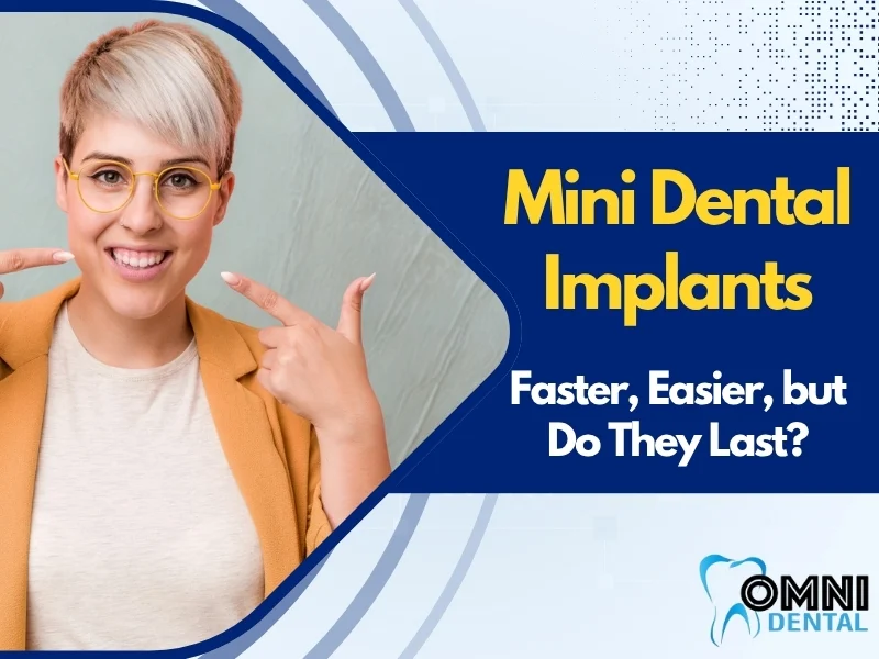Pros and Cons of Mini Dental Implants