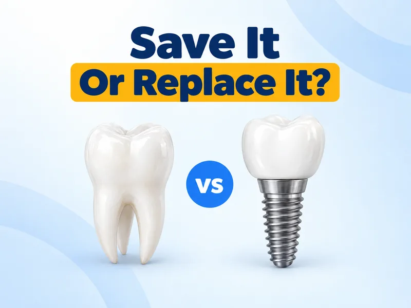 Root canal vs extraction shown as a 3D natural tooth and a 3D dental implant with a vs badge on a light blue background
