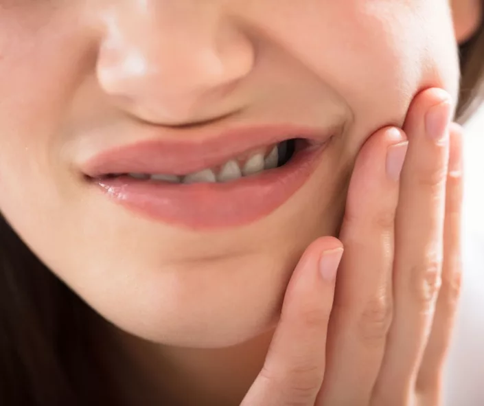 SIGN OF TOOTH DECAY