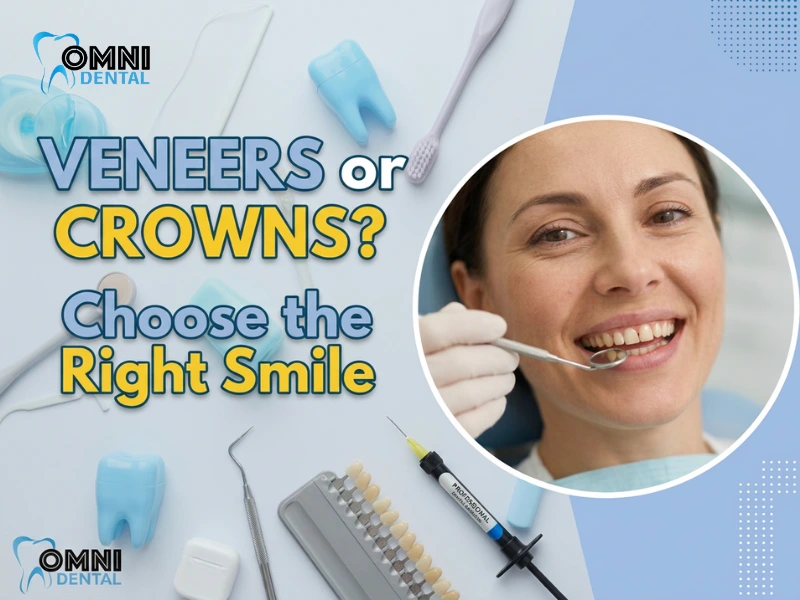 The Difference Between Veneers & Crowns