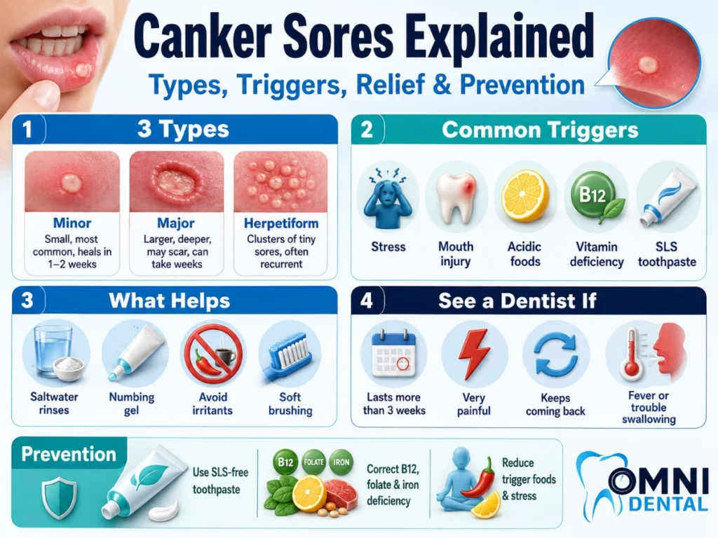 The Three Types of Canker Sore