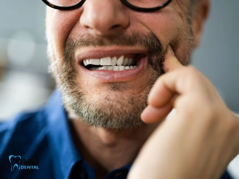 Who Is Not Suitable for Dental Implants?