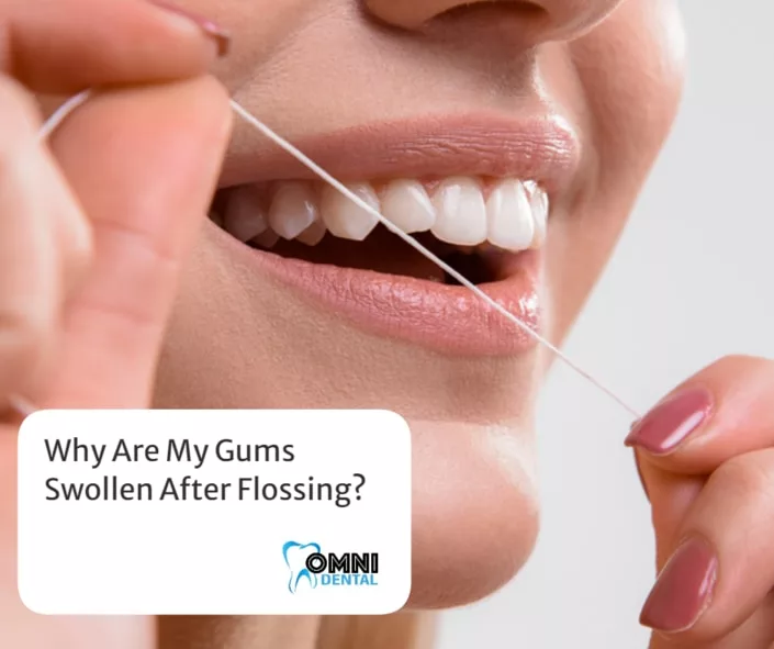 Why Are My Gums Swollen After Flossing