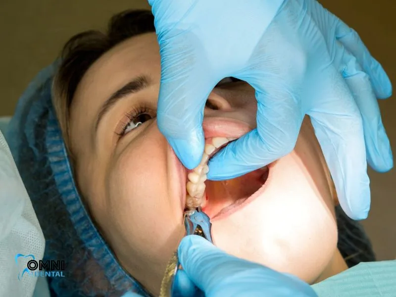Understanding Wisdom Teeth