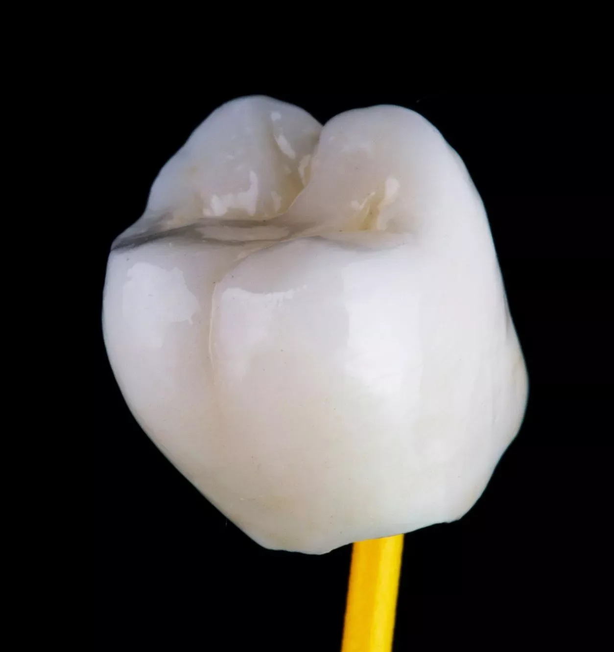 Types of Dental Crowns