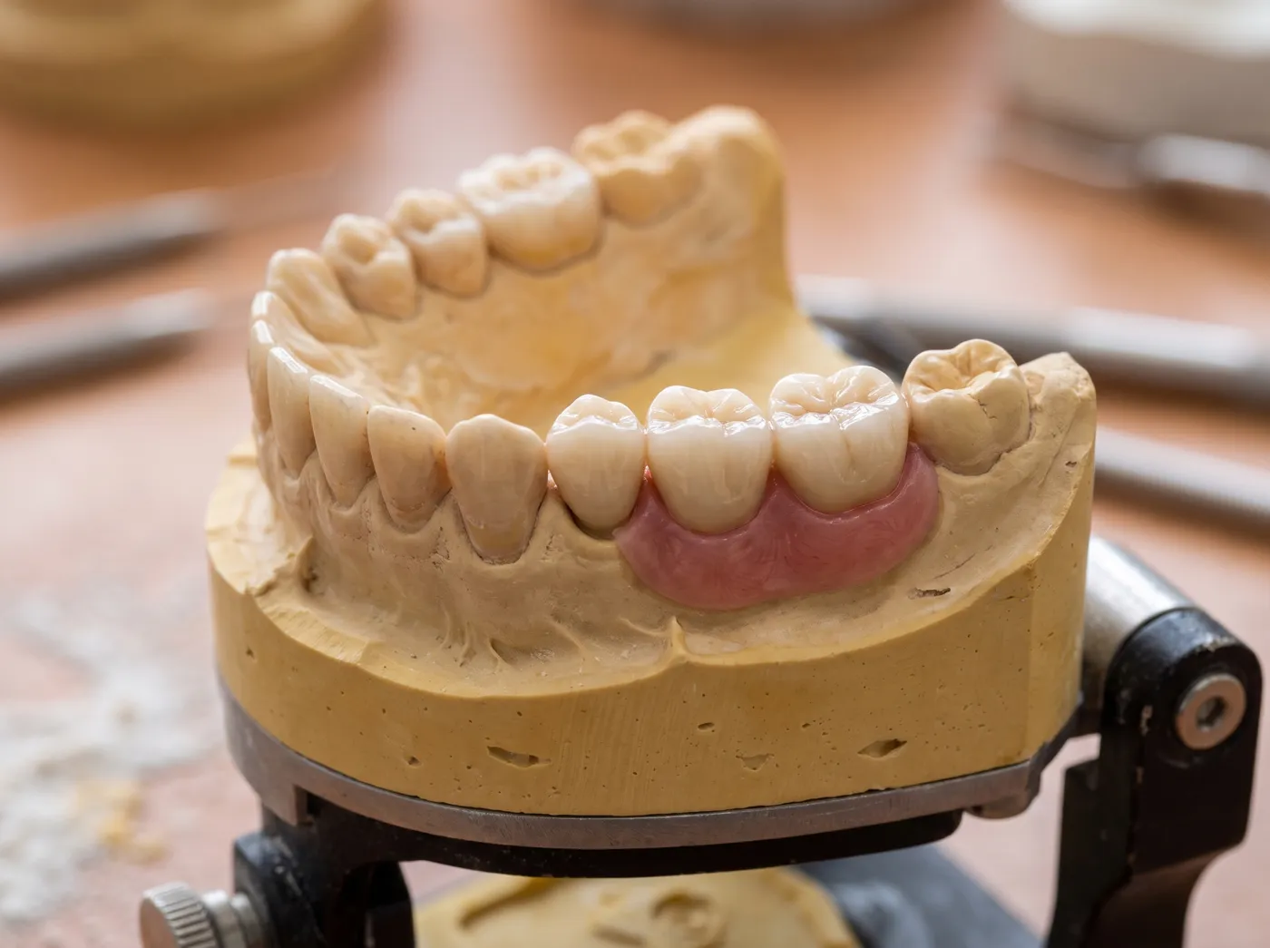 Implant patient smile at Omni Dental in Arlington Heights, IL