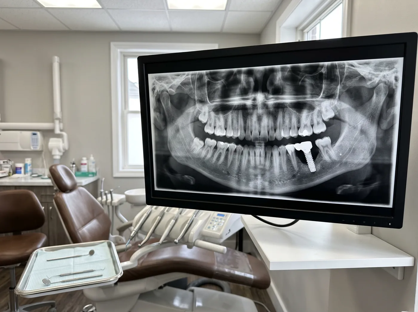 What are the dangers of one day dental implants at Omni Dental in Arlington Heights, IL