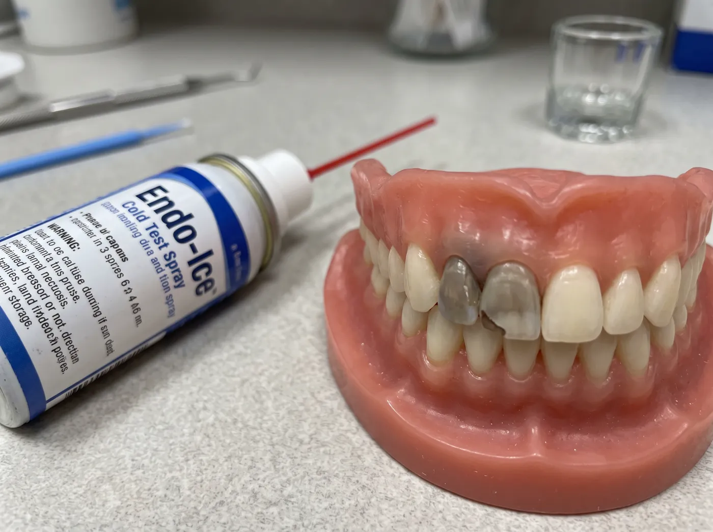 Root canal signs you may need a root canal at Omni Dental in Arlington Heights, IL