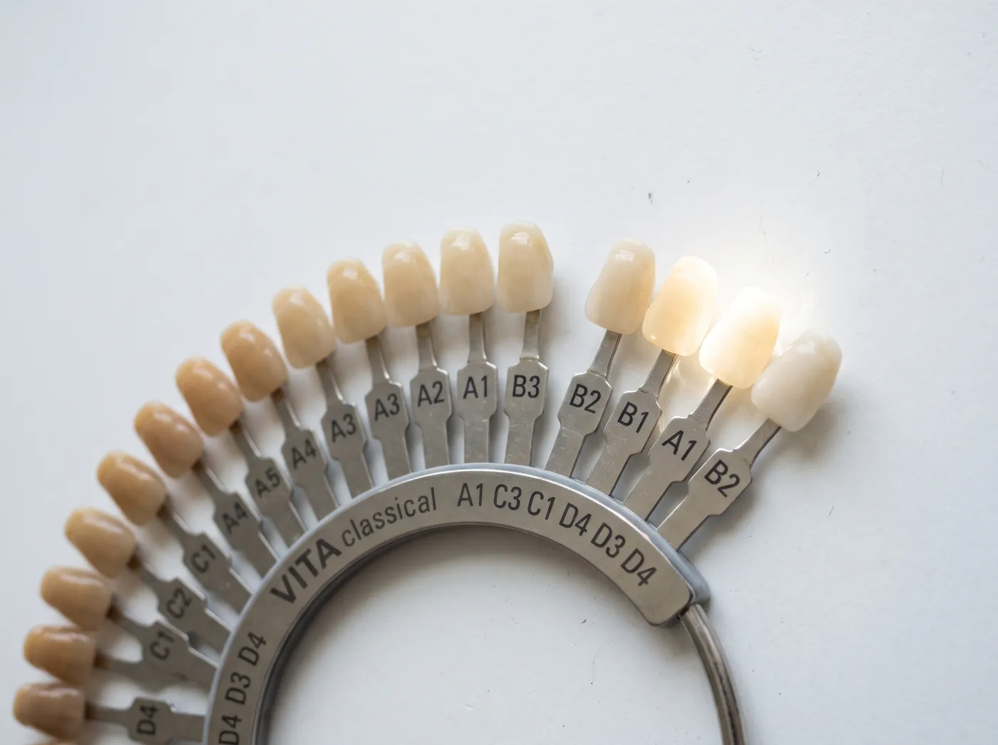 Teeth whitening how long do whitening results last at Omni Dental in Arlington Heights, IL