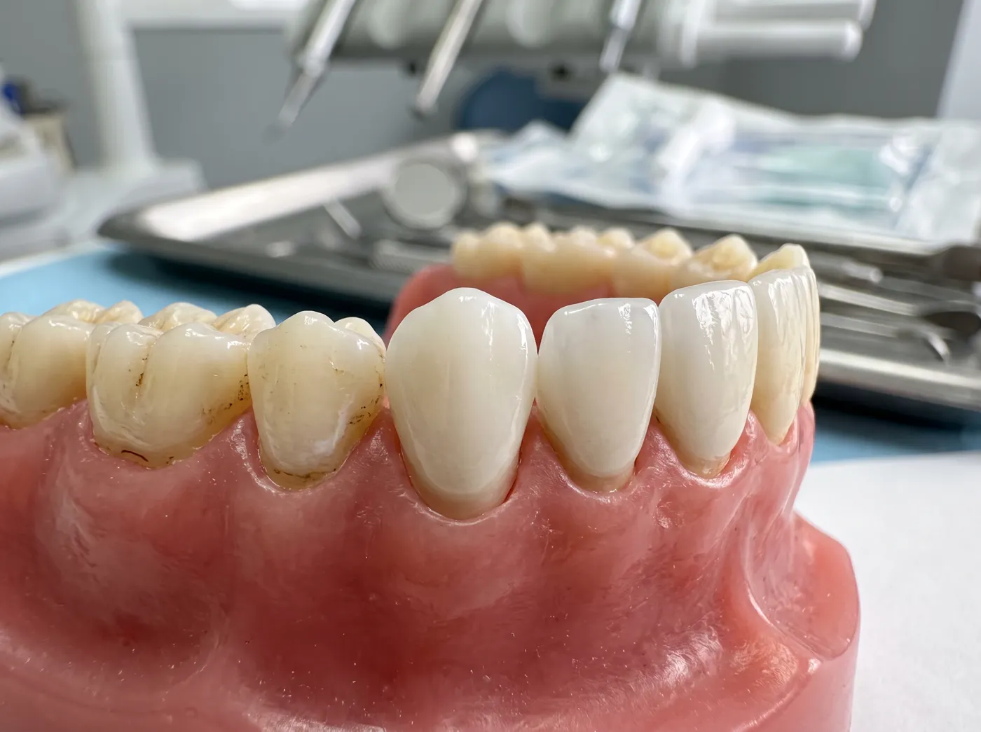 Teeth whitening when is whitening not the right choice at Omni Dental in Arlington Heights, IL