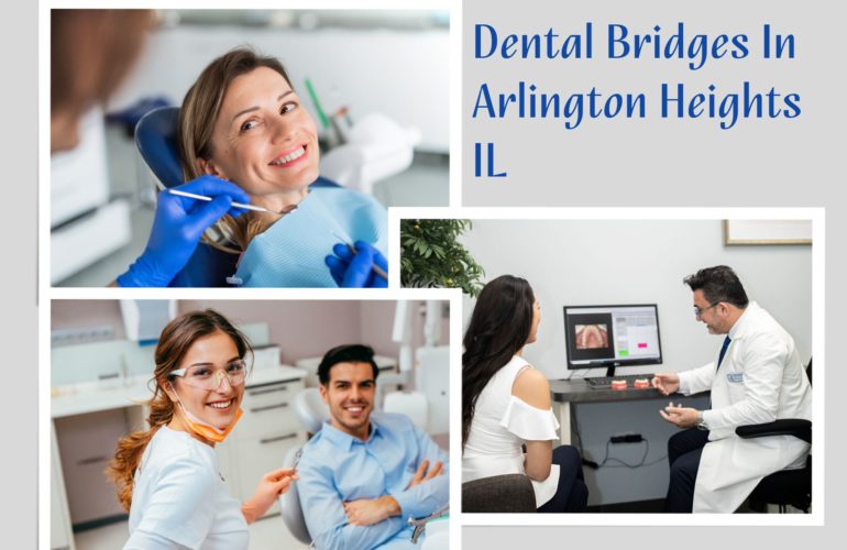 Dental Bridges In Arlington Heights IL