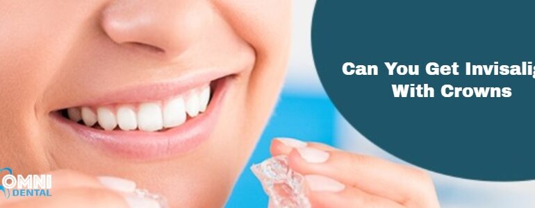 Can You Get Invisalign With Crowns