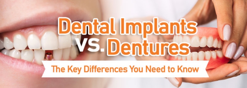 Cost Of Dental Implants in Arlington Heights IL