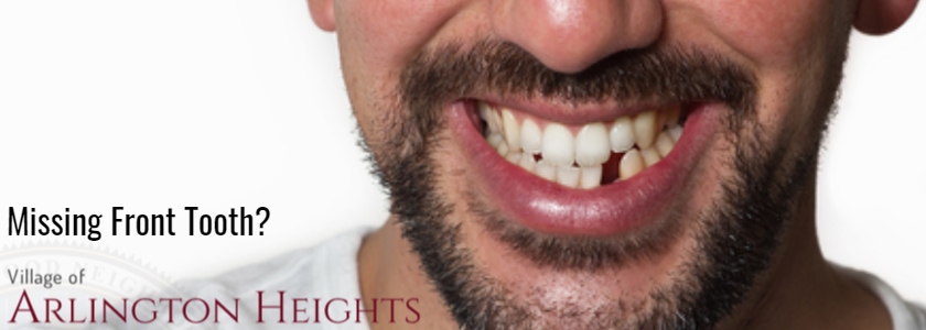 Front Tooth Replacement Options