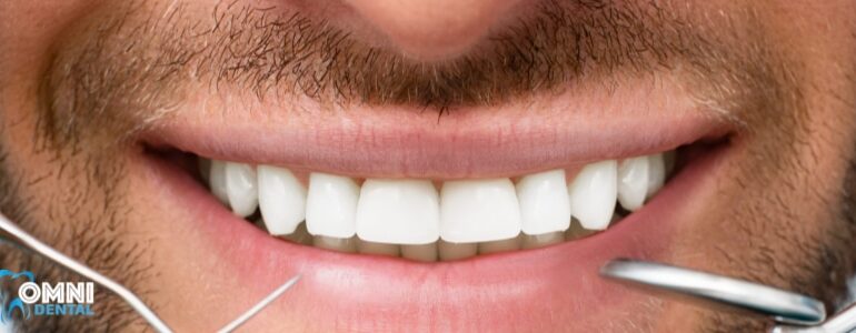 Effective Gum Disease Treatment for Beautiful Smile