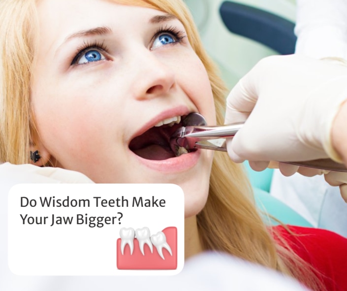 Do Wisdom Teeth Make Your Jaw Bigger