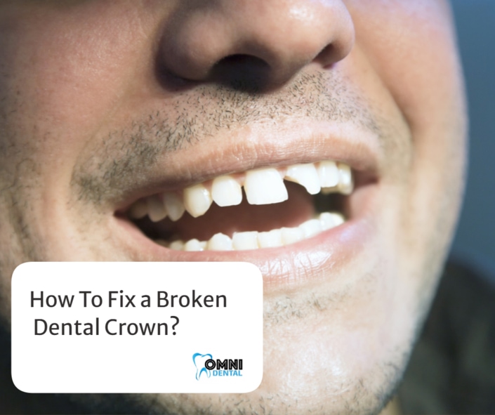 How To Fix a Broken Dental Crown