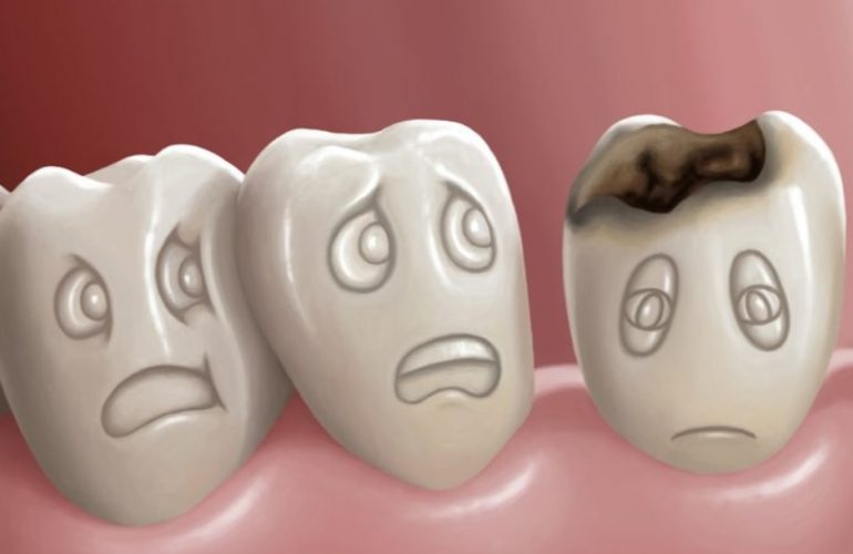 Can a Cavity Go Away On Its Own
