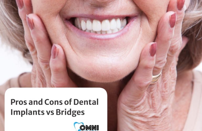 Pros and Cons of Dental Implants vs Bridges