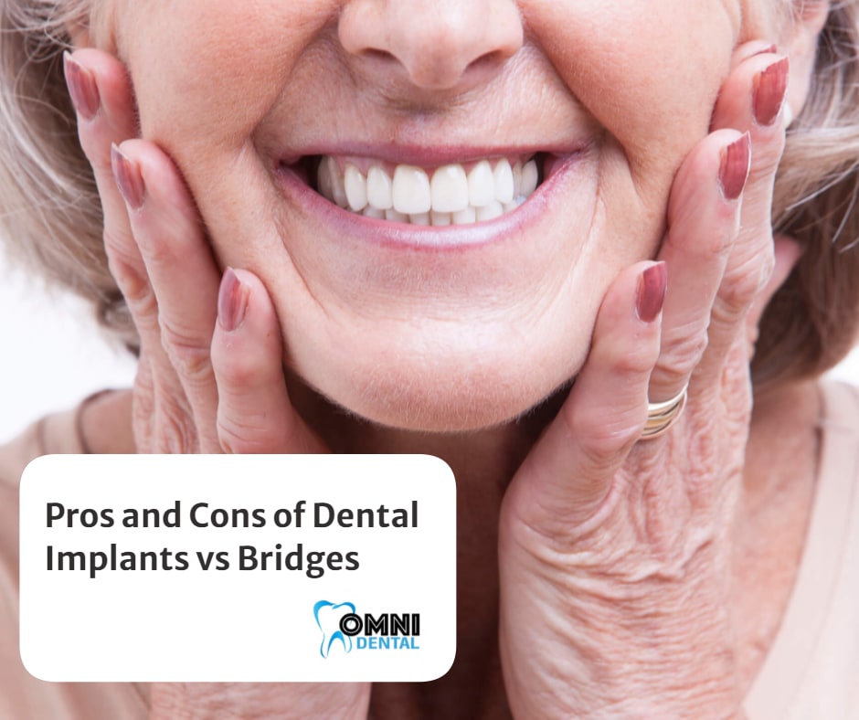 Pros and Cons of Dental Implants vs Bridges