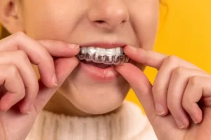 Will Invisalign Work with Missing Teeth