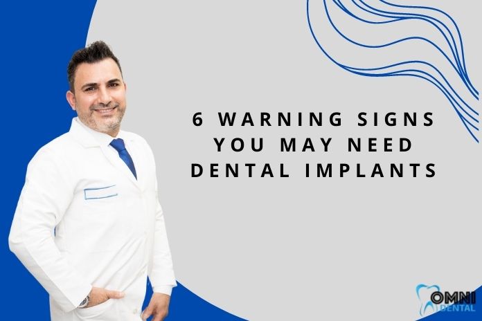 6 Warning Signs You May Need Dental Implants