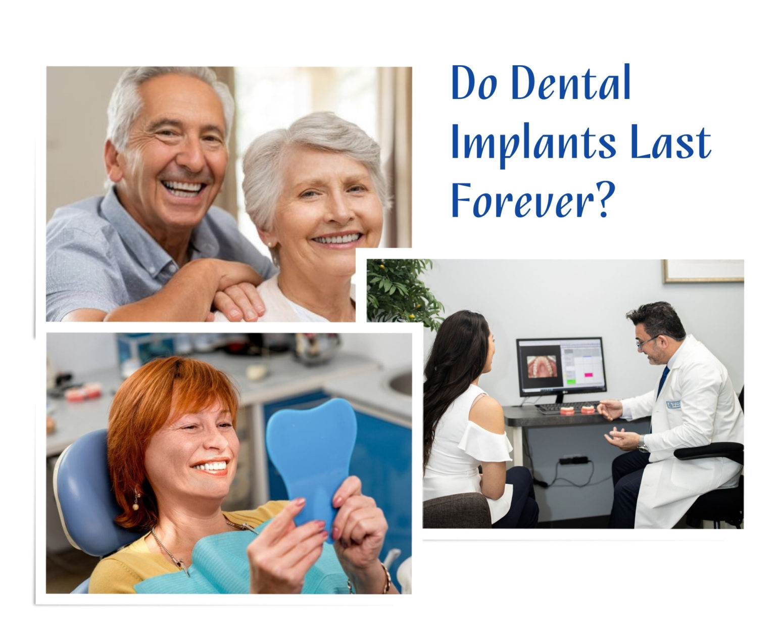 Do Dental Implants Last Forever? - Omni Dental