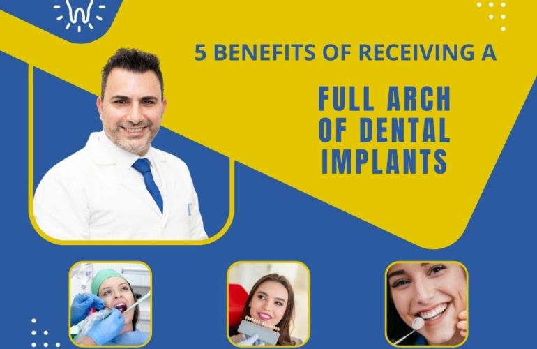 5 benefits of receiving a full arch of dental implants