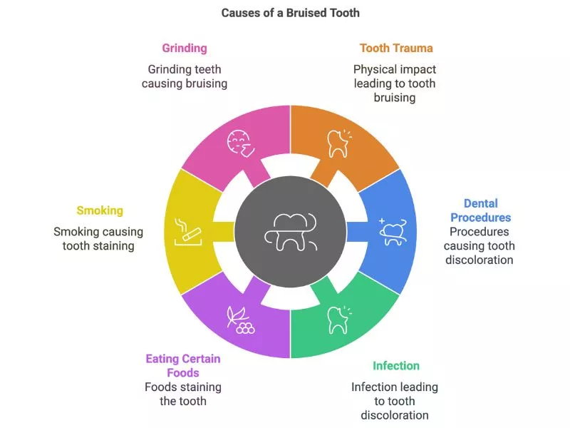 What Causes a Bruised Tooth? - Omni Dental Of Arlington Heights