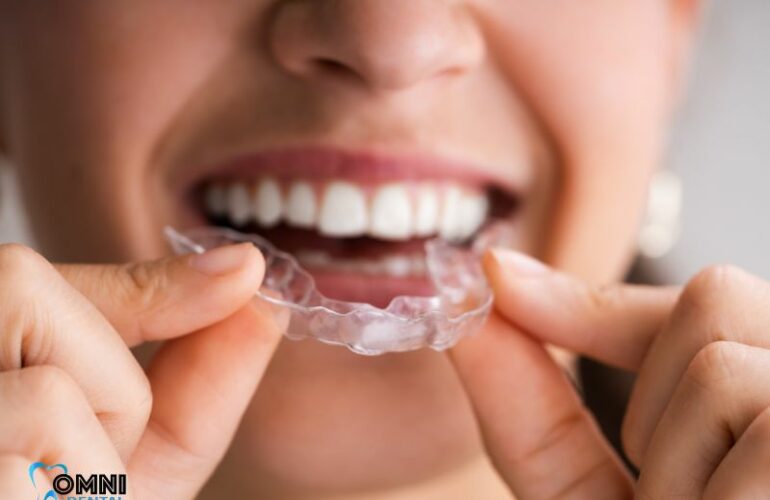 3 Reasons to Consider Clear Braces