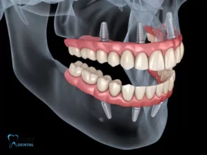Can you put a temporary tooth while waiting for an implant?